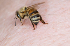 The Best Way to Treat Bee and Wasp Stings